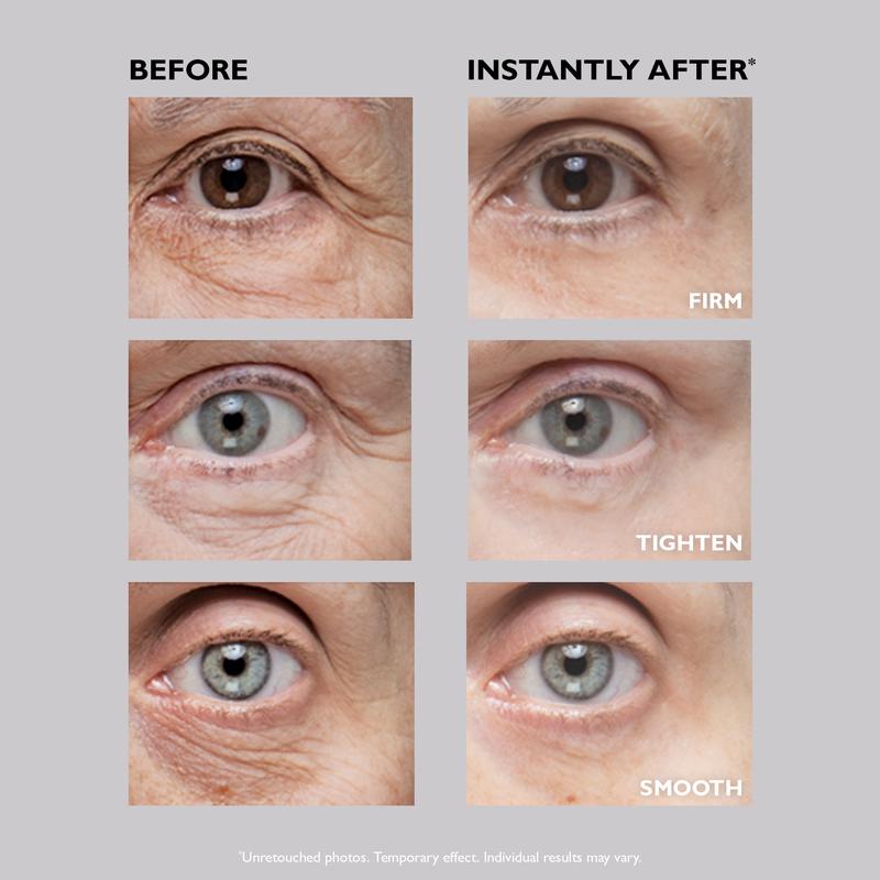 Instant FIRMx Eye Temporary Eye Tightener