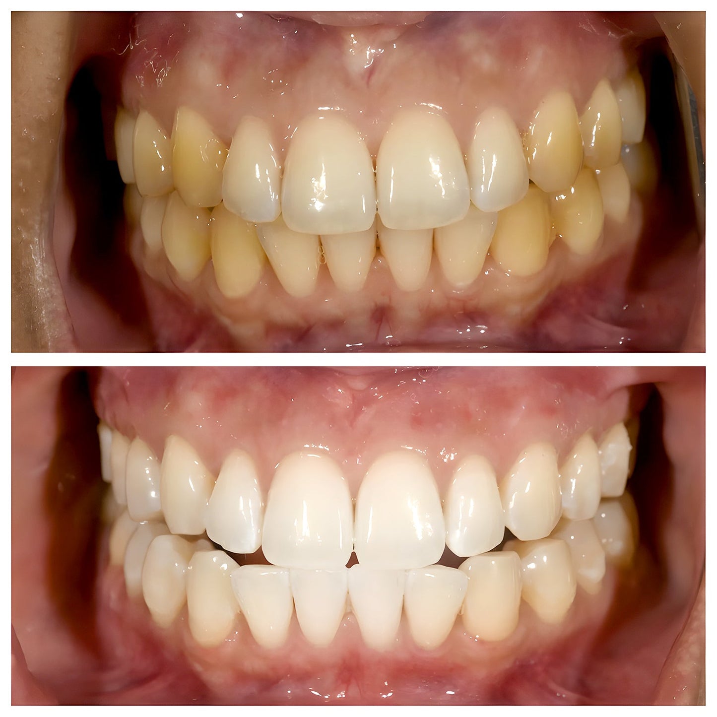 Natural Whitening And Gum Care Toothpaste