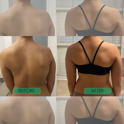 Instant Posture Corrector | Adjustable, Comfortable & Pain-Relieving